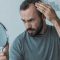 Kako ubrzati ponovni rast kose kod muškaraca?