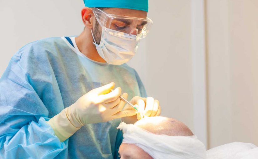 Transplantacija kose: cena, iskustva i tretman