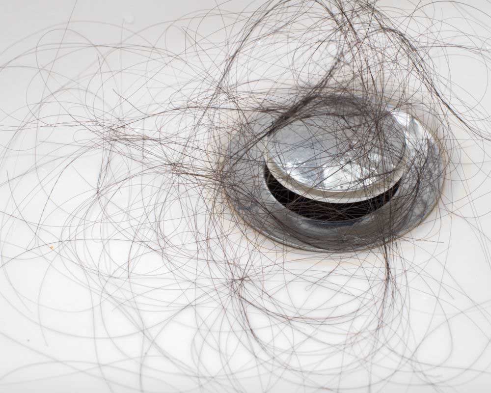 opadanje kose posle pranja