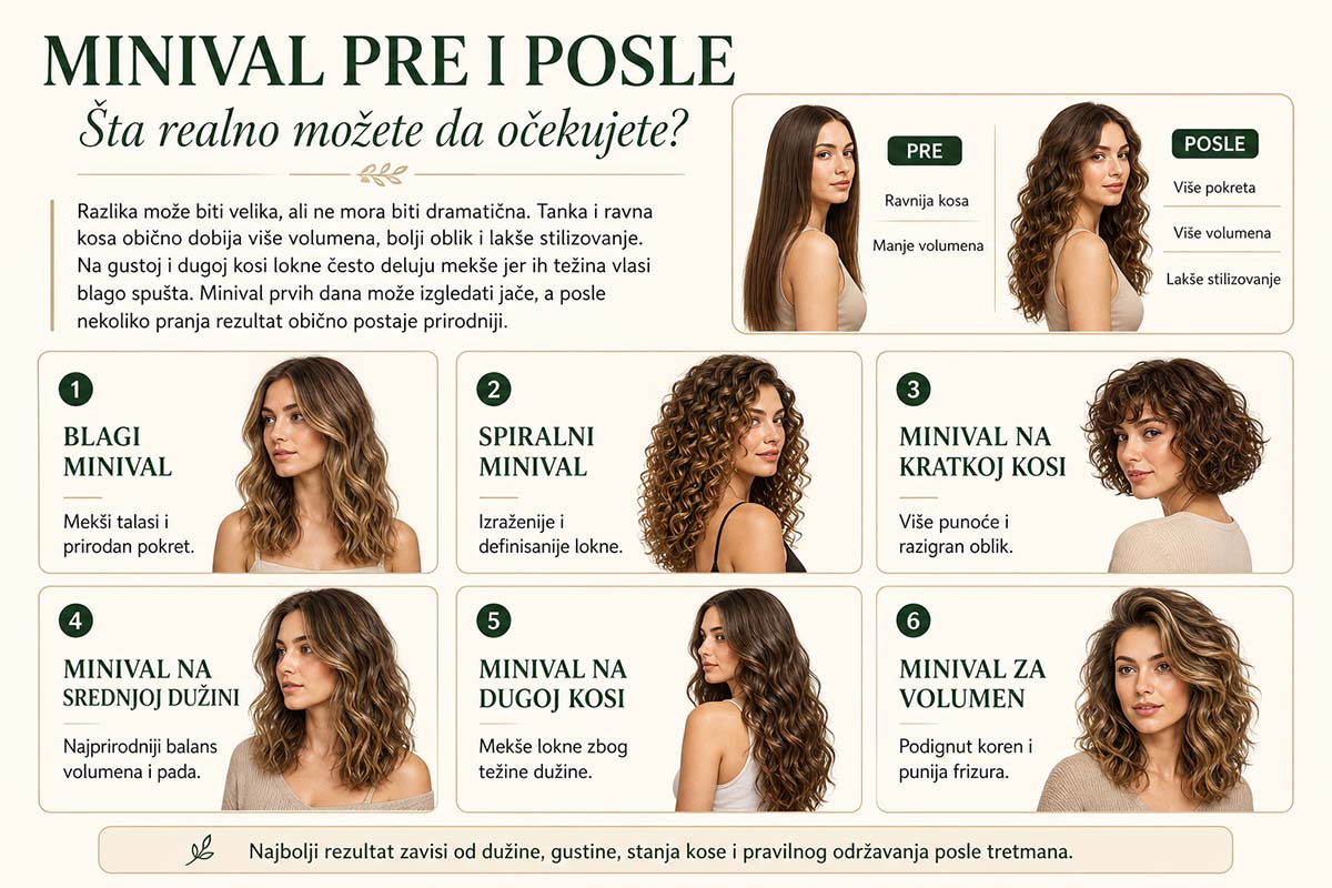 minival kose