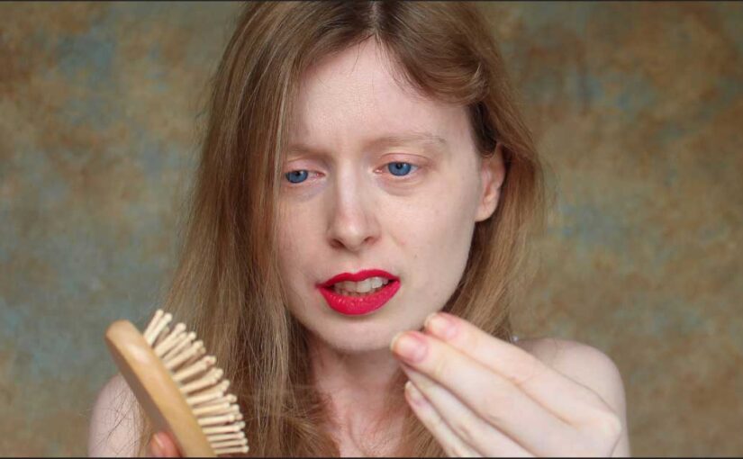 trakciona alopecija